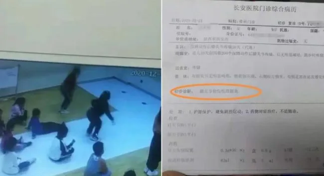 西安童学舞被罚200次深蹲致膝伤闭路电视显示「无法起身」