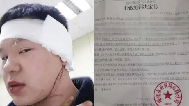 黑龙江一名男因提醒邻居夜半噪音遭暴打，网上申诉反被以行拘和被公司解职